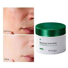 خریدژل سالیسیلیک اسید بیواکوا